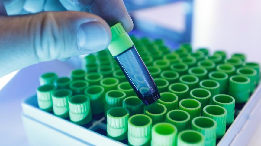  315曝光后，外泌体市场风云突变；企业回应与临床探索并行。 健康养生 315曝光后，外泌体市场风云突变；企业回应与临床探索并行。 健康养生 315曝光后，外泌体市场风云突变；企业回应与临床探索并行。 健康养生